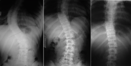 Рентгенография - основной метод диагностики