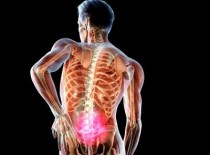 Боли в пояснице слева