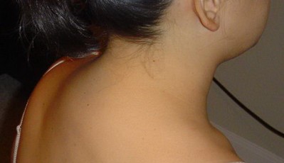 Вдовий горб